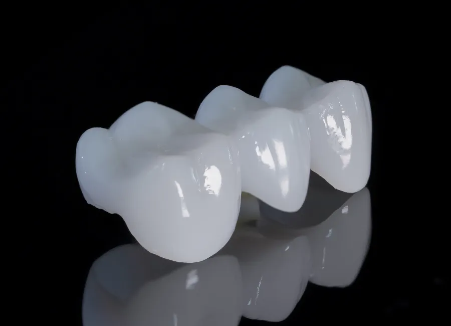 Dental Bridges at [pracitice_name] in Las Vegas, NM