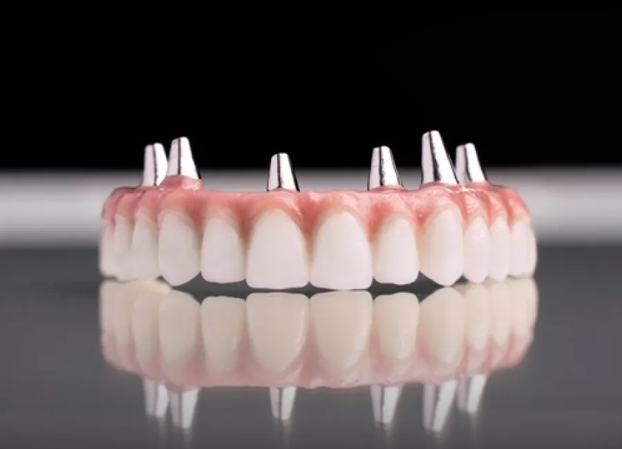 Implant Supported Dentures at [pracitice_name] in Las Vegas, NM