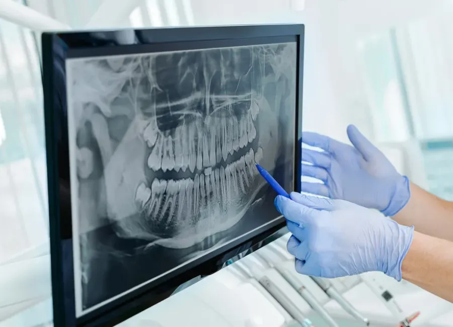 Panoramic X Rays at [pracitice_name] in Las Vegas, NM